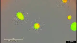 Murine-Derived Glioma Organoids and Cell Line Culture Systems