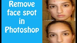 How to remove spot and soft skin in Photoshop