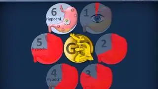 Optimization of upper gastrointestinal endoscopy: value of real time gastric juice analysis