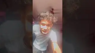 ഇത് വല്ലാത്തെ experience ആയിപോയി...😭❌|  First time leg fracture experience