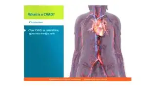 Central Lines Skills: What is a CVAD
