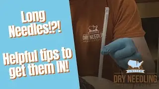 LONG NEEDLES! Helpful dry needling tips to insert large and long needles