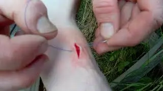 How to stitch a wound in the field