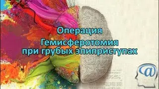 Операция. Функциональная гемисферотомия при тяжелых эпиприступах. Нейрохирургия