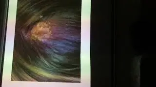 Dermatology revision Cases