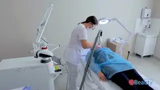 Лечение розацеа лазером