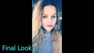 Lip Enhancement with Filler | Dr. Anthony Bared, MD, FACS Miami, FL