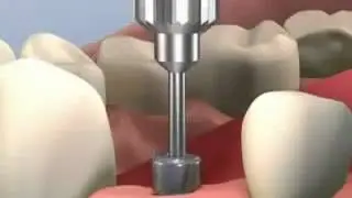 Simulation en 3D
