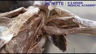 Demonstration of front of arm final