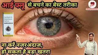 आई फ्लू क्यों होता है,जानिए कारण और इलाज. Eye flu(pink eye), conjuctivitis, causes & treatment.