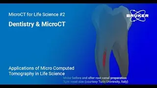 Dentistry & MicroCT | Applications of MicroCT in Life Science #2
