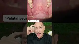 Dokter gigi bisa tau kalau kamu habis Oral Sex❓😱😭