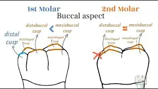 Differences between Mandibular 1st & 2nd Molar