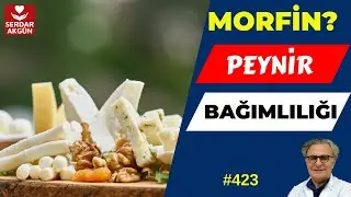 423. Peynir Bağımlılığı, Peynir Zararları, Sağlık Videoları, Serdar Akgün, Sağlıklı Beslenme