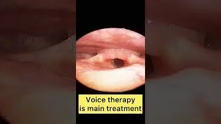 Ageing Voice | Vocal Gap | Hoarse Voice | Phonatory Gap