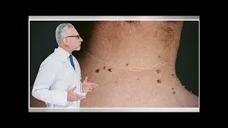 Papiloma humano, un enemigo silencioso: pero la naturaleza tiene la cura!