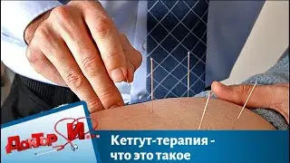 Кетгут-терапия - что это такое | Доктор И