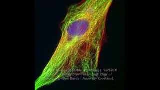 Single-photon image of fixed cells