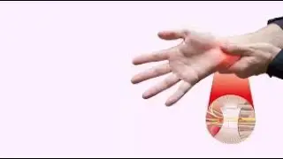 7 Exercises to HEAL Carpal Tunnel FAST (Try These NOW!)