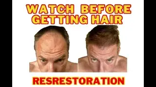 Hair restoration process what do you expect the tips and tricks of things to do and not to do
