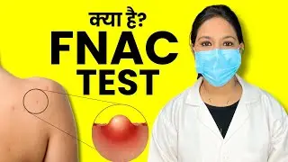 FNAC Test Kya Hota Hai? Kaise Kiya Jata Hai?