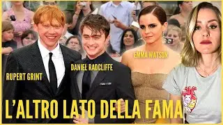 La vita dopo Harry Potter: Daniel Radcliffe, Emma Watson e Rupert Grint prima e dopo la fama