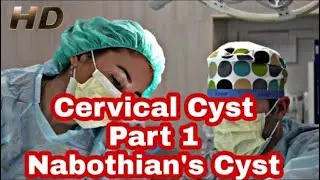 Nabothian'sCyst|Causes,Risk Factors, Symptoms,Diagnosis&Treatment|Electrocautery Ablation Therapy