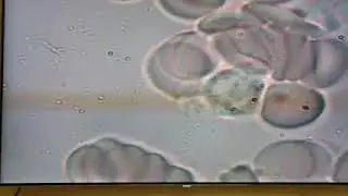 Как Elev8 улучшает кровь? Отвечает врач и темнопольный микроскоп