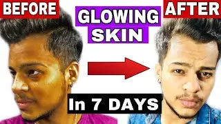 How To Get Glowing Skin At Home Naturally In 7 Days | 3 Home Remedies For Glowing Skin 100% Guranted
