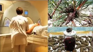 Stroke. Harvest time of ripe pine cones. (Stroke - NO).