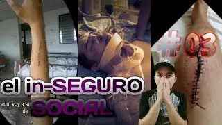 👨‍🦽👨🏼‍🦯🚶🏻‍♂️Recuperacion de accidente👩‍🦽👩‍🦯🚶🏼‍♀️ Seguro social
