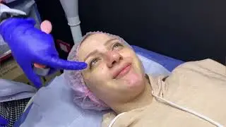 عملت عملية تفتكروا ايه الحاجة اللى غيرتها فيا او عملتها🫣