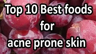 Top 10 best foods for acne prone skin