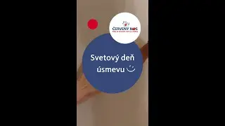Červený nos odpovedá: Čo ti vždy vyčaruje úsmev na tvári? 🔴