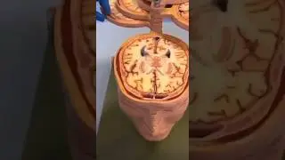 Very creative way of studying the brain 🧠 #mbbs #subscribe #medstudent