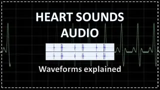 Normal Heart Sounds | Auscultation | Audio |