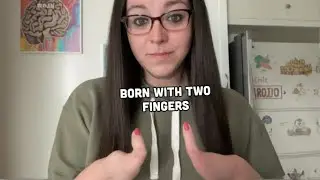 I Was Born With Two Fingers! 😲 | STORYTRENDER
