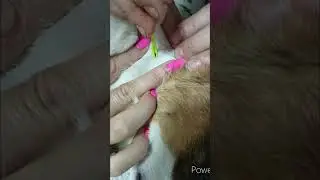 как снять клеща🕷️ 