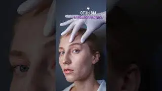 Отзывы моих прекрасных пациенток после блефаропластики