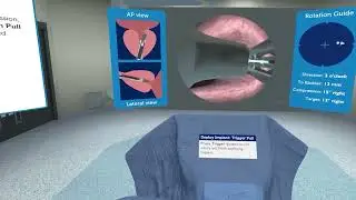Teleflex UroLift® Overview