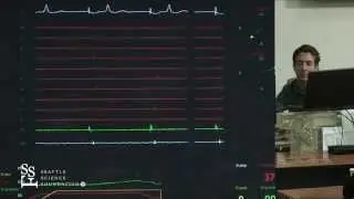 Atrial Flutter Simulation Demonstration by Adam Zivin, M.D.