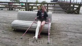 ALICE pretty girl LLC long leg plaster cast, Full leg - Amputee Tv