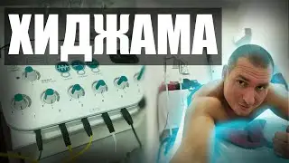СДЕЛАЛ ХИДЖАМУ НА ГОЛОДАНИИ