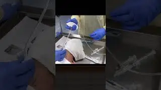 Transtracheal Needle Jet Ventilation