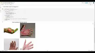 Human Hand Palm Recognition Module