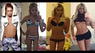 the truth.. i had illegal silicone injections