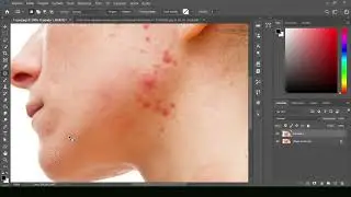Removendo Cravos e Espinhas Photoshop.
