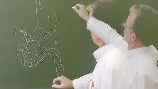 Схема панкреато-дуоденальной резекции