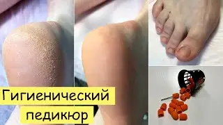 ПЕДИКЮР без покрытия | Обработка стопы песочными колпачками LUKAS