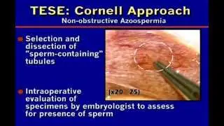 Dr. Peter N. Schlegel: Microdissection TESE:Sperm Retrieval in Non-obstructive Azoospermia (2007)